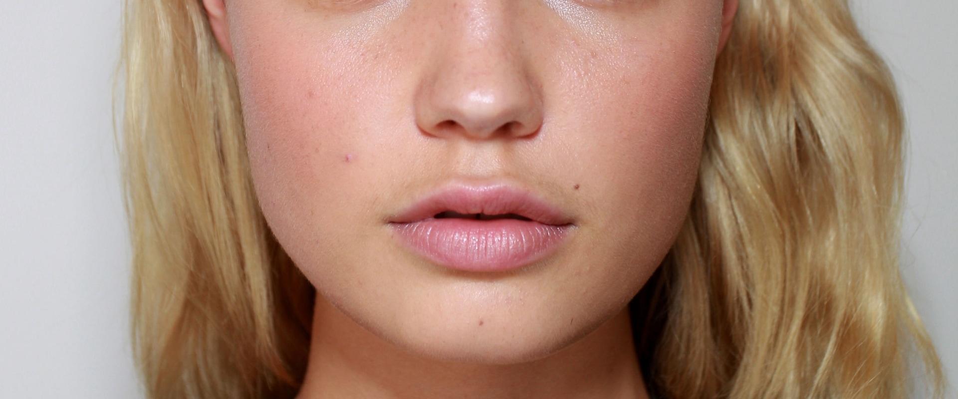 Do Lip Fillers Look Obvious? Expert Advice on Natural-Looking Results