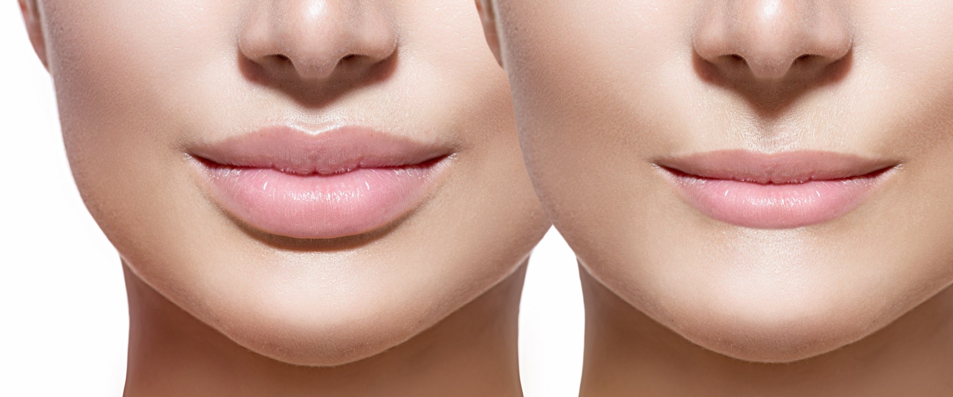 Which lip filler is the best?