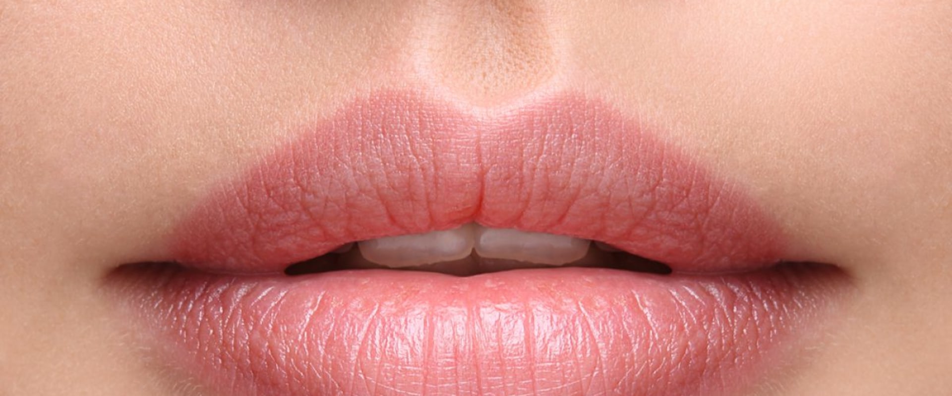 What is the Longest Lasting Lip Filler?