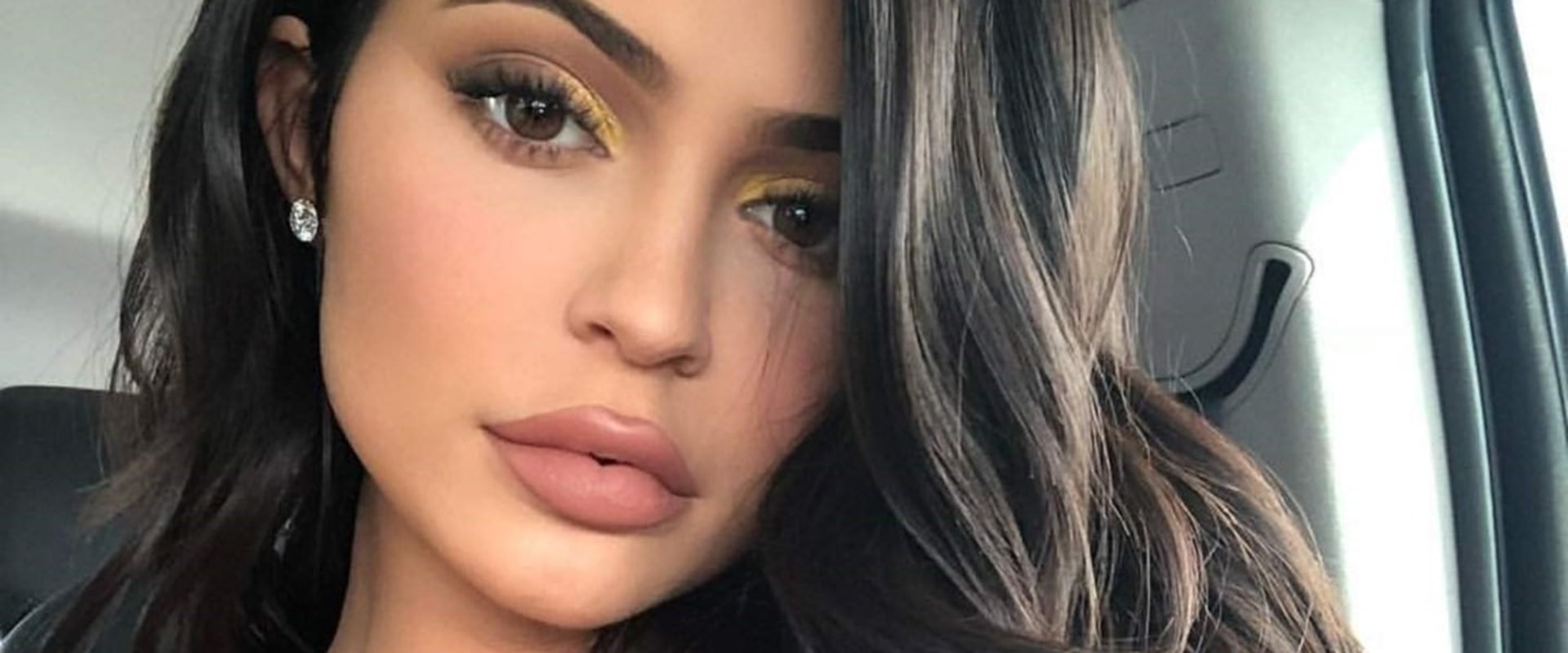 Are Lip Fillers Safe? A Comprehensive Guide