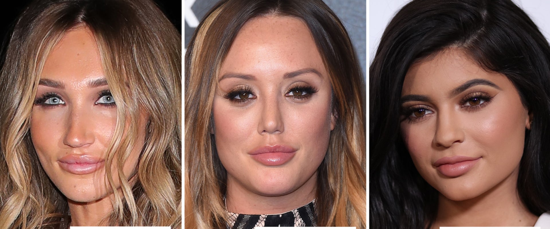 Celebrities Who Got Lip Fillers: A Comprehensive Guide