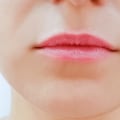 How Much Should Lip Fillers Cost?