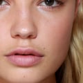 Will Lip Fillers Even Out? A Comprehensive Guide