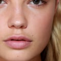 How Much Do Standard Lip Fillers Cost?