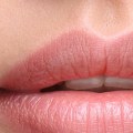 What is the Longest Lasting Lip Filler?