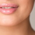 How to Stop Your Lips from Hurting After Fillers