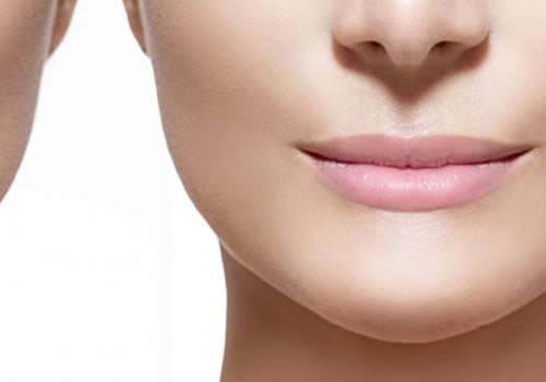 What Happens When Lip Fillers Wear Off?