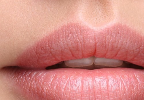 What is the Best Lip Filler for Long-Term Results?