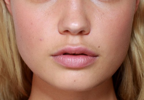 Do Lip Fillers Look Obvious? Expert Advice on Natural-Looking Results