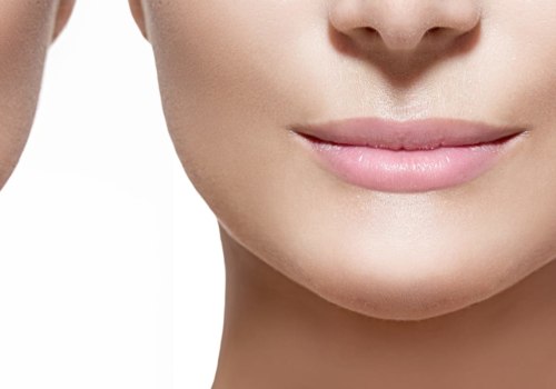 Which Facial Filler Lasts the Longest?