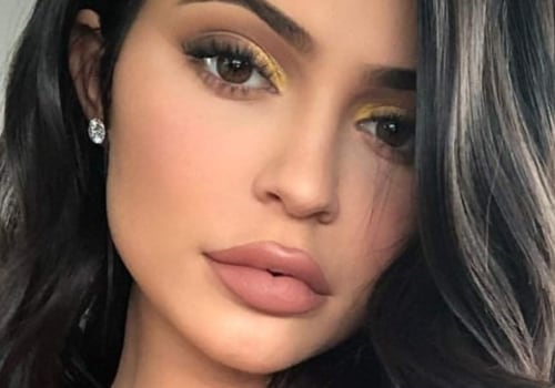 Are Lip Fillers Safe? A Comprehensive Guide